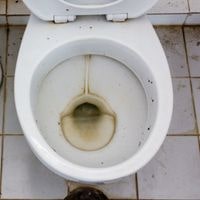 causes of toilet ring