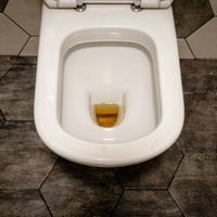 brown water in toilet